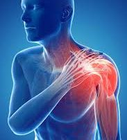 Bolečine v ramenih